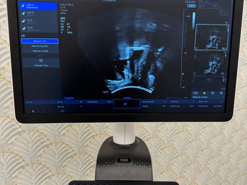 Monitor para relizar ecografías