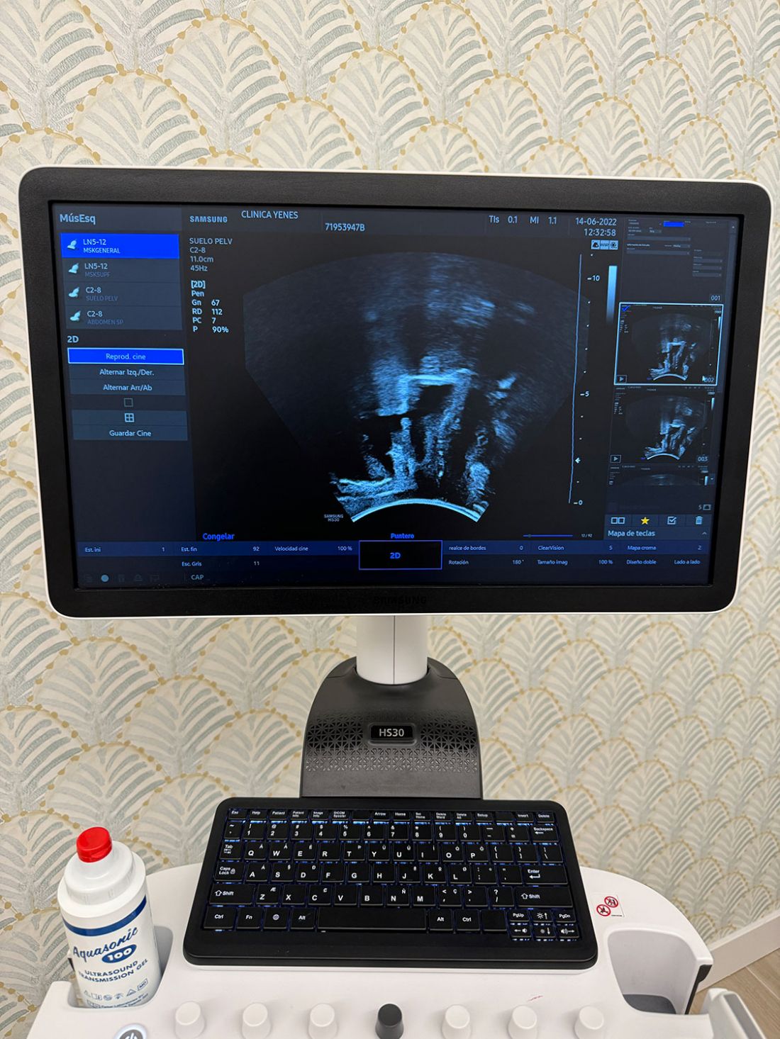 Monitor para relizar ecografías