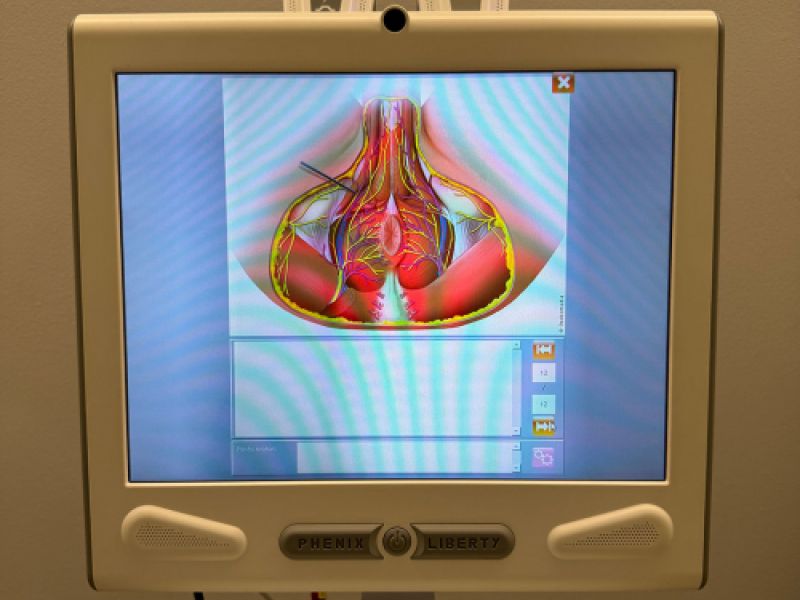 Ordenador con pantalla e imagen de pelvis