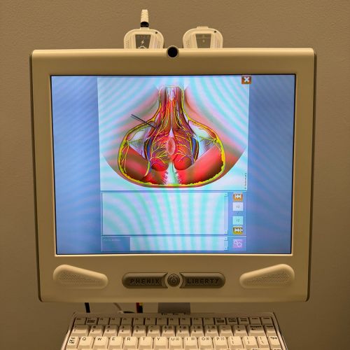 Ordenador con pantalla e imagen de pelvis