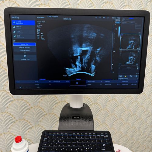 Monitor para relizar ecografías